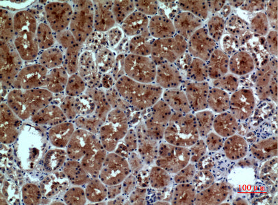 Anti-Neuropilin 1 Rabbit Polyclonal Antibody