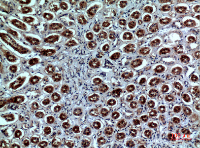 Anti-Neuropilin 1 Rabbit Polyclonal Antibody