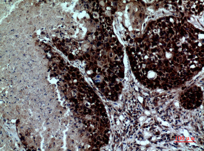 Anti-Integrin alpha 4 Rabbit Polyclonal Antibody