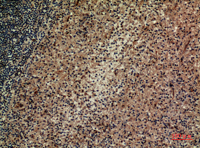 Anti-Integrin alpha 4 Rabbit Polyclonal Antibody