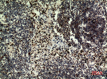 Anti-HRP3 Rabbit Polyclonal Antibody