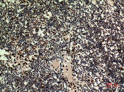 Anti-HRP3 Rabbit Polyclonal Antibody