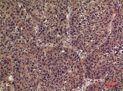 Anti-IL-36 beta Rabbit Polyclonal Antibody