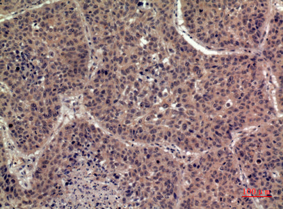 Anti-IL-36 beta Rabbit Polyclonal Antibody