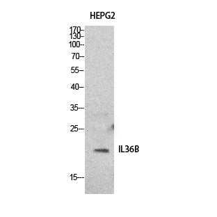 Anti-IL-36 beta Rabbit Polyclonal Antibody
