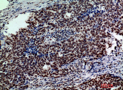 Anti-GLB1 Rabbit Polyclonal Antibody