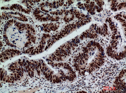 Anti-GLB1 Rabbit Polyclonal Antibody