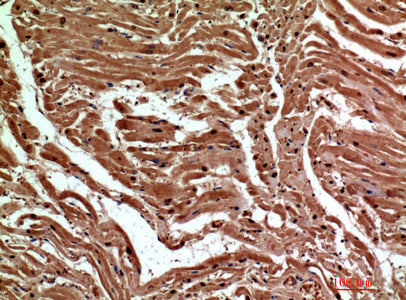 Anti-Dectin-2 Rabbit Polyclonal Antibody