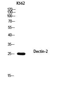 Anti-Dectin-2 Rabbit Polyclonal Antibody
