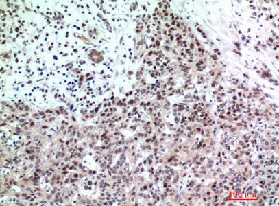 Anti-TP53INP2 Rabbit Polyclonal Antibody