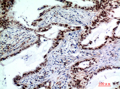 Anti-TP53INP2 Rabbit Polyclonal Antibody