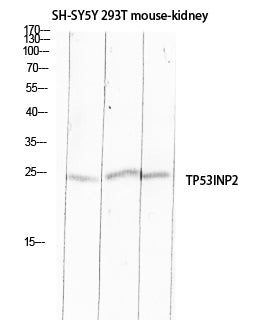 Anti-TP53INP2 Rabbit Polyclonal Antibody