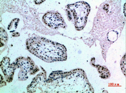 Anti-NOP56 Rabbit Polyclonal Antibody