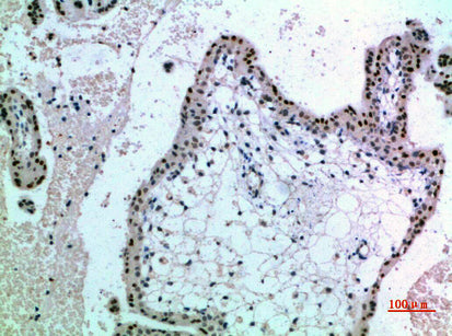 Anti-NOP56 Rabbit Polyclonal Antibody