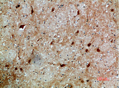 Anti-NFAT5 Rabbit Polyclonal Antibody