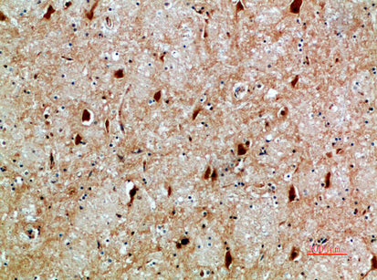 Anti-NFAT5 Rabbit Polyclonal Antibody
