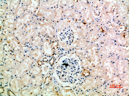 Anti-IL-18 Receptor Accessory Protein Rabbit Polyclonal Antibody