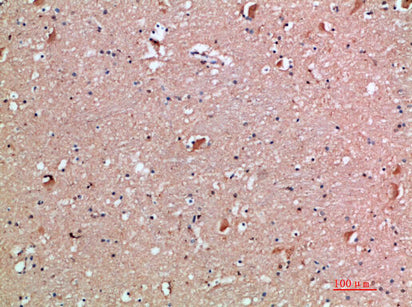 Anti-IL-18 Receptor Accessory Protein Rabbit Polyclonal Antibody