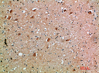 Anti-IL-18 Receptor Accessory Protein Rabbit Polyclonal Antibody
