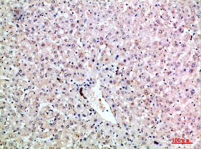 Anti-LTB Rabbit Polyclonal Antibody