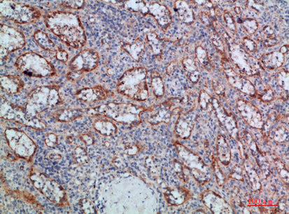 Anti-LTB Rabbit Polyclonal Antibody