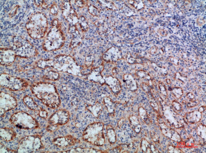 Anti-LTB Rabbit Polyclonal Antibody