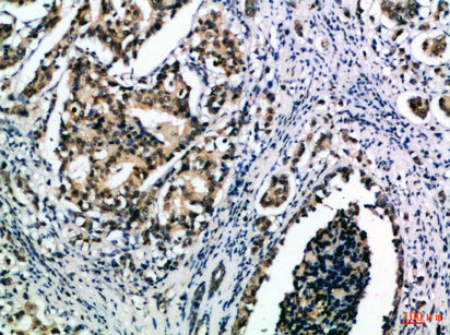 Anti-IL-15 Rabbit Polyclonal Antibody