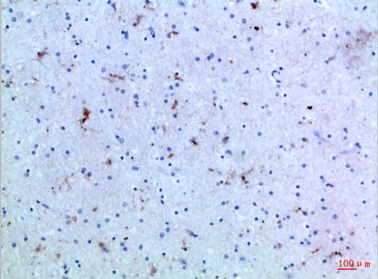 Anti-IL-15 Rabbit Polyclonal Antibody