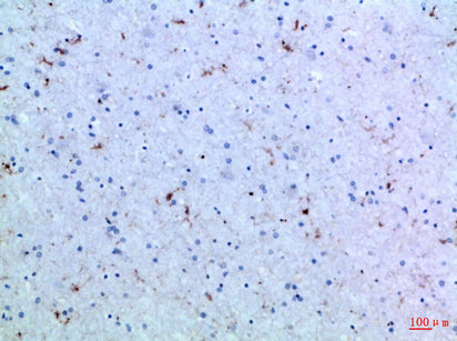 Anti-IL-15 Rabbit Polyclonal Antibody