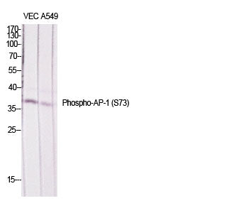 Anti-Phospho-JunD (Ser73/100) Rabbit Polyclonal Antibody