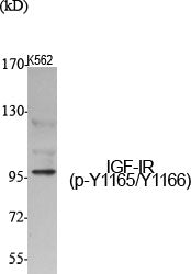Anti-Phospho-IGF1 Receptor (Tyr1165/Tyr1166) Rabbit Polyclonal Antibody