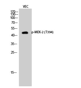 Anti-Phospho-MEK2 (Thr394) Rabbit Polyclonal Antibody