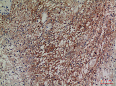 Anti-NRG2 Rabbit Polyclonal Antibody