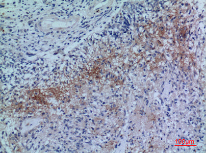 Anti-Neuropilin 2 Rabbit Polyclonal Antibody