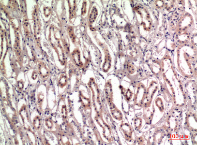 Anti-Tenascin Rabbit Polyclonal Antibody