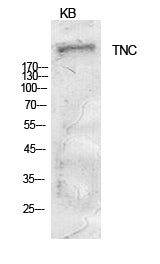 Anti-Tenascin Rabbit Polyclonal Antibody