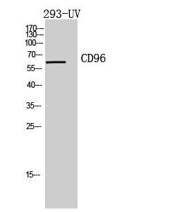 Anti-CD96 Rabbit Polyclonal Antibody