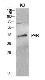 Anti-CD155 Rabbit Polyclonal Antibody