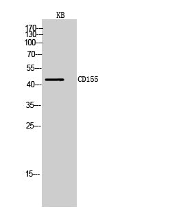Anti-CD155 Rabbit Polyclonal Antibody