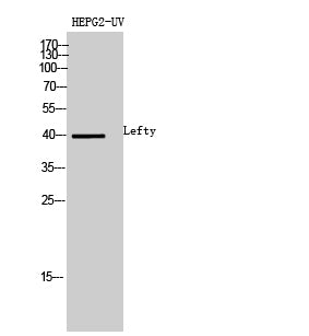 Anti-LEFTY Rabbit Polyclonal Antibody