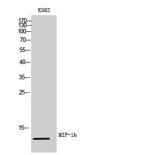 Anti-CCL4L Rabbit Polyclonal Antibody