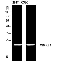 Anti-MRPL35 Rabbit Polyclonal Antibody