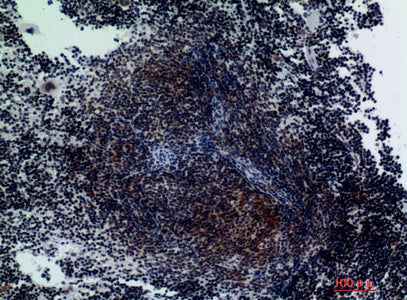 Anti-Integrin alpha 3 Rabbit Polyclonal Antibody