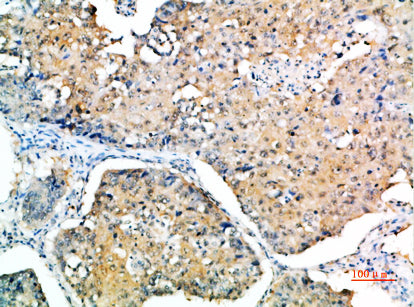 Anti-SOCS3 Rabbit Polyclonal Antibody