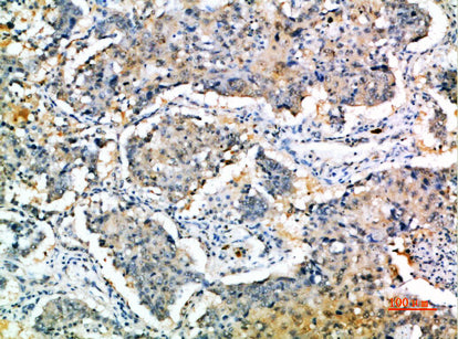 Anti-SOCS3 Rabbit Polyclonal Antibody
