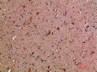 Anti-NNT1 Rabbit Polyclonal Antibody