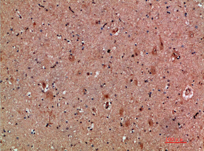 Anti-NNT1 Rabbit Polyclonal Antibody