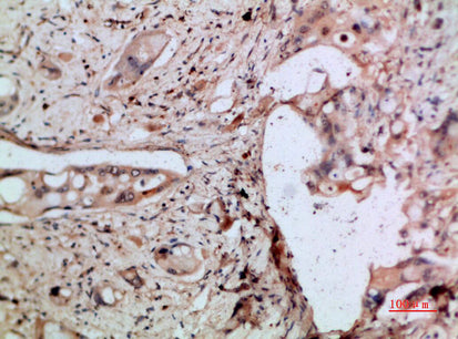 Anti-ENA 78 Rabbit Polyclonal Antibody