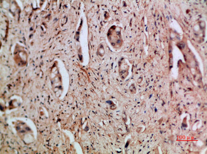 Anti-ENA 78 Rabbit Polyclonal Antibody