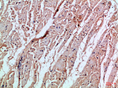 Anti-MIA Rabbit Polyclonal Antibody